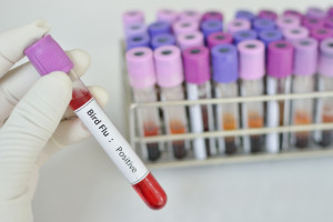 Francja: zbliża się szczepienie przeciwko grypie ptaków