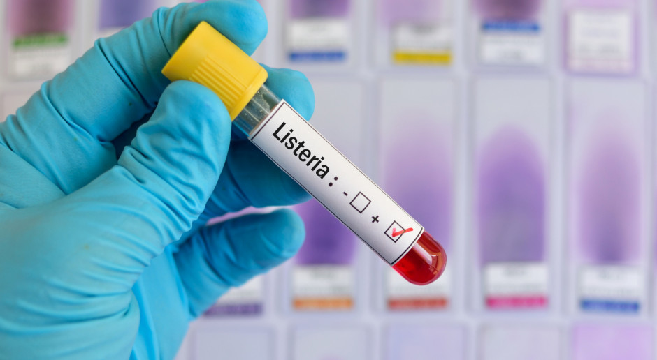 Przeciętnie w Południowej Afryce odnotowuje około 60 przypadków listeriozy rocznie; Fot. Shutterstock Epidemia listeriozy zbiera śmiertelne żniwo i dziesiątkuje trzodę w RPA