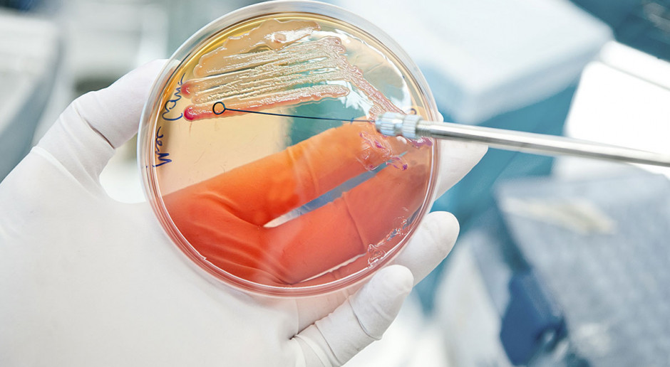 Antybiotyki w produkcji zwierzęcej: Potrzeba odpowiedzialności