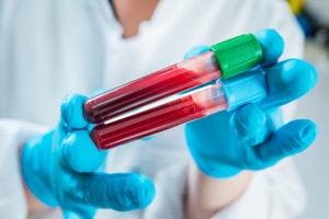 Weterynarz stanie przed sądem za propozycję podmiany próbki świńskiej krwi