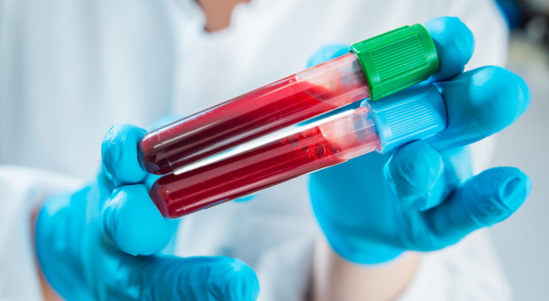 Weterynarz stanie przed sądem za propozycję podmiany próbki świńskiej krwi