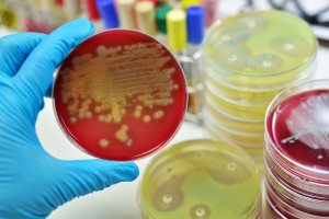 UE: Spór o stosowanie rezerwowych antybiotyków w hodowli