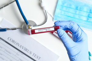 Jeden z wiceministrów rolnictwa zakażony koronawirlsem